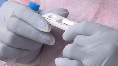 Gobierno del Valle entrega pruebas de antígeno para detectar el dengue